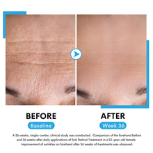 Load image into Gallery viewer, Soti 2.5% Retinol Serum, Formulated in USA! Reduces Wrinkles, Age Spots, Post-Acne Marks. Stimulates Collagen, Firm Skin, Anti Aging with Hyaluronic Acid, Niacinamide (30ml)
