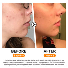 Load image into Gallery viewer, Soti Vitamin C Anti-aging Face Serum 20% Vitamin C Concentrated To Reduces Wrinkles, Dark Spots & Acne, Brightens Skin Tone and Restores Radiance Formulated in USA, 1 fl.oz. 30ml