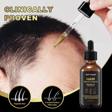 Load image into Gallery viewer, Soti Minoxidil 5% Hair Growth, Hair Loss Regrowth Serum 60ml. Formulated in USA! Dermatologists Recommended. Ginseng and Biotin Extra Strength Formula