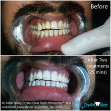 Load image into Gallery viewer, Crystal Clear Teeth Whitening Gel Refill - 5 Pack