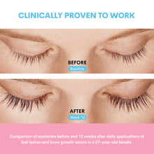 Load image into Gallery viewer, Soti Eyelashes and Eyebrows Growth Serum, Dermatologists Developed Formula with Peptides, Keratin and Biotin. Made in USA!