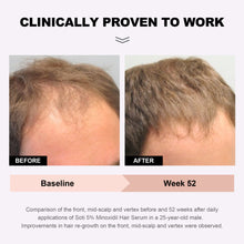 Load image into Gallery viewer, Soti Minoxidil 5% Hair Growth, Hair Loss Regrowth Serum.  Formulated in USA!  Dermatologists Recommended. Extra Strength Formula (3 Pack)