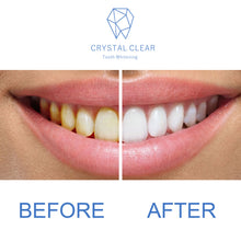 Load image into Gallery viewer, Crystal Clear Teeth Whitening Gel Refill - 3 Pack