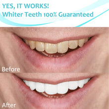 Load image into Gallery viewer, Crystal Clear Teeth Whitening Strips, Teeth, Dental Grade Professional White Strips for Sensitive Teeth, Coconut Flavor, 28 Strips, 14 Treatments