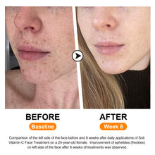 Load image into Gallery viewer, Soti Vitamin C Anti-aging Face Serum 20% Vitamin C Concentrated To Reduces Wrinkles, Dark Spots & Acne, Brightens Skin Tone and Restores Radiance Formulated in USA, 1 fl.oz. 30ml