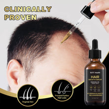 Load image into Gallery viewer, Soti Minoxidil 5% Hair Growth, Hair Loss Regrowth Serum.  Formulated in USA!  Dermatologists Recommended. Extra Strength Formula (3 Months Supply)