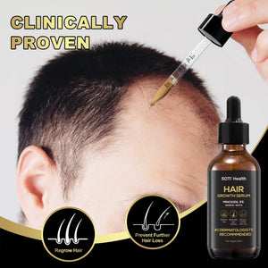 Soti Minoxidil 5% Hair Growth, Hair Loss Regrowth Serum.  Formulated in USA!  Dermatologists Recommended. Extra Strength Formula (3 Months Supply)