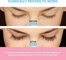 Load image into Gallery viewer, Castor Oil (500 ml), USDA Certified Organic, 100% Pure, Cold Pressed, Hexane Free by Soti. Stimulate Growth for Eyelashes, Eyebrows, Hair, Skin Moisturizer
