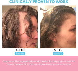 Rosemary Oil for Hair Growth 2 Fl Oz, Pure Organic Rosemary Essential Oils Serum for Dry Damaged Hair and Growth, Hair Loss Scalp Treatment, Soti