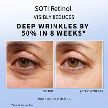 Load image into Gallery viewer, Retinol Eye Cream Dark Circles Fade Fine Lines Remove Eye Bags Anti-Wrinkle Anti-Aging Firming Brighten Skin 30g