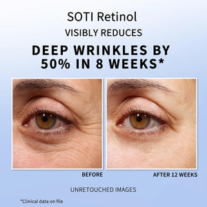 Retinol Eye Cream Dark Circles Fade Fine Lines Remove Eye Bags Anti-Wrinkle Anti-Aging Firming Brighten Skin 30g