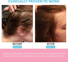 Load image into Gallery viewer, Rosemary Oil for Hair Growth 2 Fl Oz, Pure Organic Rosemary Essential Oils Serum for Dry Damaged Hair and Growth, Hair Loss Scalp Treatment, Soti