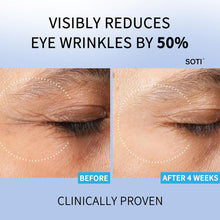 Load image into Gallery viewer, Retinol Eye Cream Dark Circles Fade Fine Lines Remove Eye Bags Anti-Wrinkle Anti-Aging Firming Brighten Skin 30g