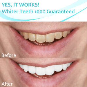 Crystal Clear Teeth Whitening Strips, Teeth, Dental Grade Professional White Strips for Sensitive Teeth, Coconut Flavor, 28 Strips, 14 Treatments
