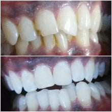 Load image into Gallery viewer, crystal clear teeth whitening results